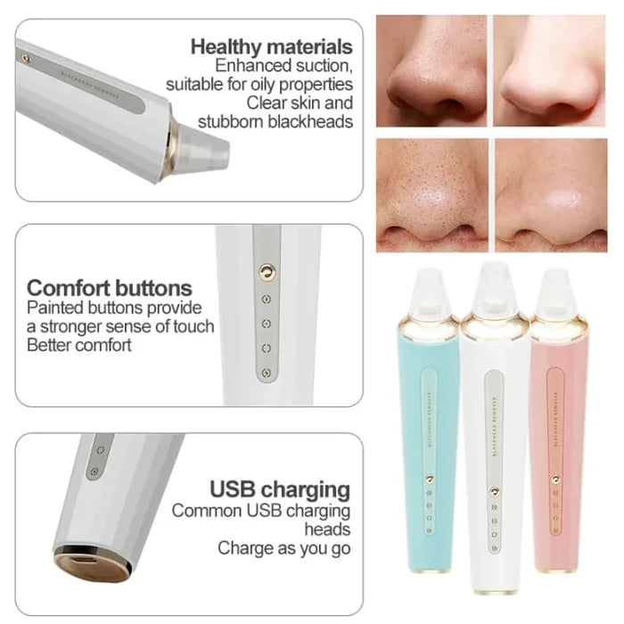 Rechargeable Facial Pore Cleaner & Blackhead Remover Vacuum | Pore Suction Device Kit for Deep Skin Cleaning & Blackhead Removal Beauty Tool (Charging Version)