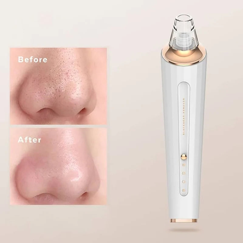 Rechargeable Facial Pore Cleaner & Blackhead Remover Vacuum | Pore Suction Device Kit for Deep Skin Cleaning & Blackhead Removal Beauty Tool (Charging Version)